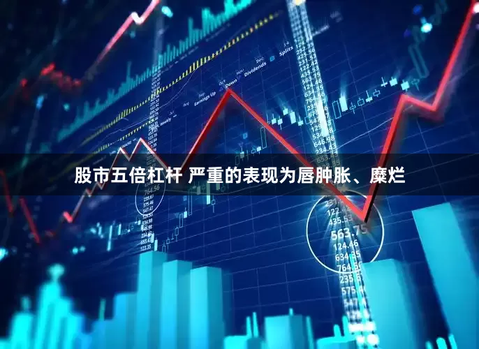 股市五倍杠杆 严重的表现为唇肿胀、糜烂